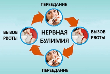 Лечение булимии во Владикавказе
